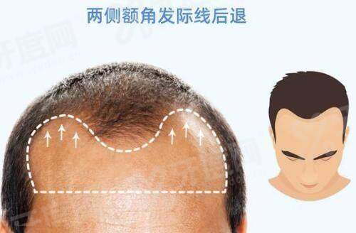 二、上海滕彦医生双眼皮如何yanke.yadoo.cn