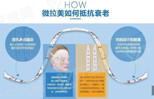 上海滕彦医生修复双眼皮价格：埋线2.8k/切开4.5/韩式三双眼皮修复价格3.8k元起