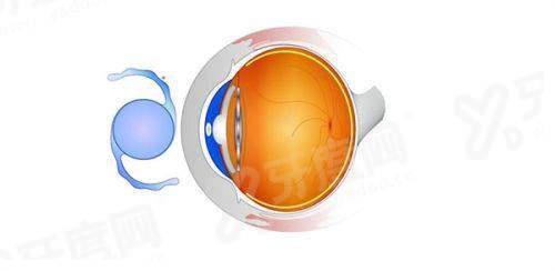 大麦植发在线咨询入口：正规医院，用户评价都说植发成效好！