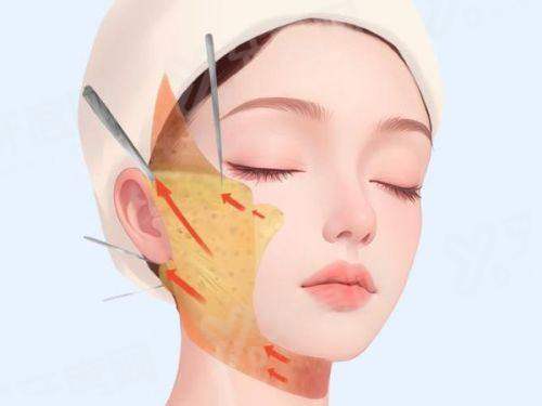 银川比较好的植发医院有哪些？银川大麦微针/碧莲盛/新生植发医院上榜前三！