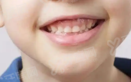 三、北京大兴区人民医院口腔科价格表？（公开透明，价格合理）yanke.yadoo.cn