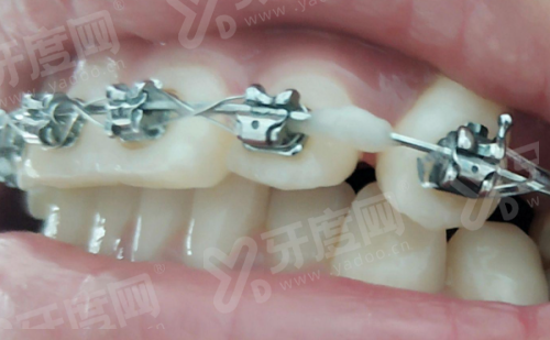 天津阳光树口腔医院是正规医院吗？2家可靠牙科！附种植/矫正价格表+地址电话！