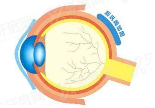 广西视光中心做全飞秒手术费用：全飞秒1.76W元起