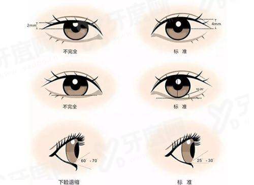 男生隆胸增加1 - 2个罩杯不会被发现，8k元起