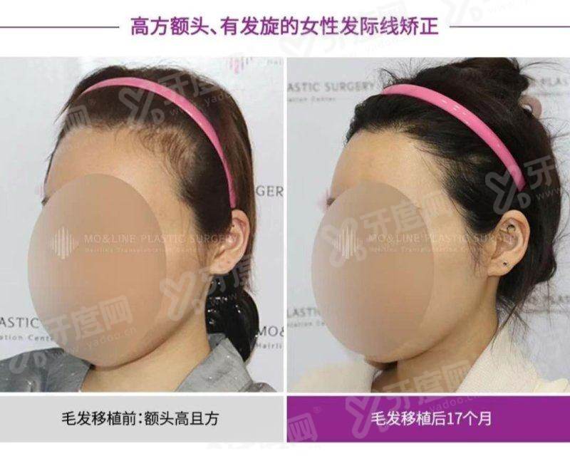 法芮娅属于什么档次？高端档次，德国的来看法芮娅为什么贵！