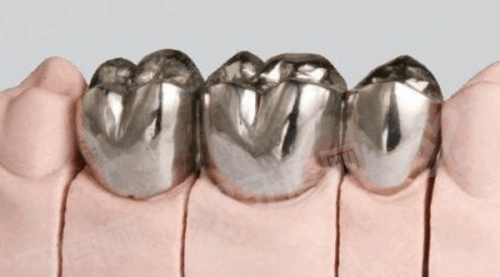 三、韩国维钛种植牙价格1980起yanke.yadoo.cn