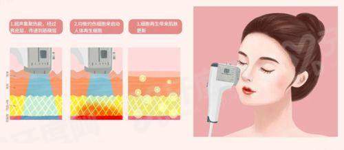 二、换人工耳蜗是恒久性的吗yanke.yadoo.cn