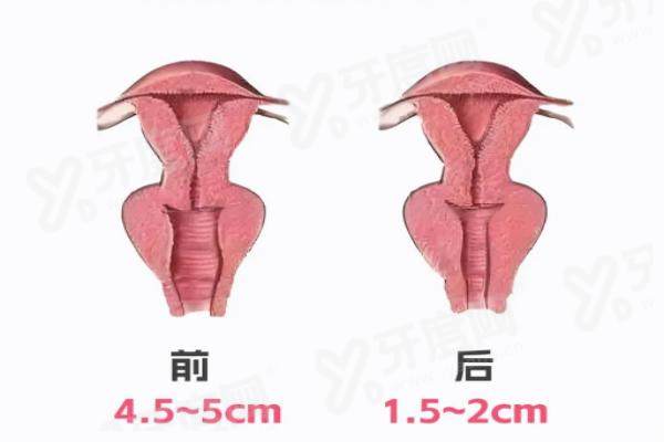 广州建国女性生殖整形手术咋样？价格表参考+口碑评价了解更多