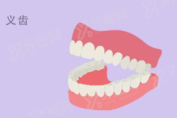 温州吸附性义齿哪个医院好？温州艺星口腔/牙博士口腔/好牙医口腔医院排名前三