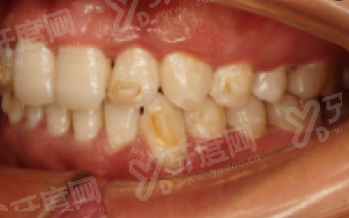 三、天津美呀植联口腔医院预约挂号攻略？（多种预约方式，操作简单便捷）yanke.yadoo.cn