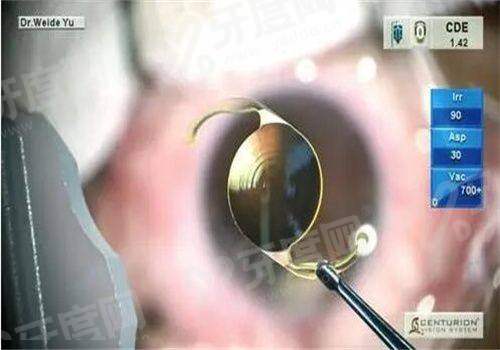 四、合肥沃瑞眼科医院预约挂号方式yanke.yadoo.cn