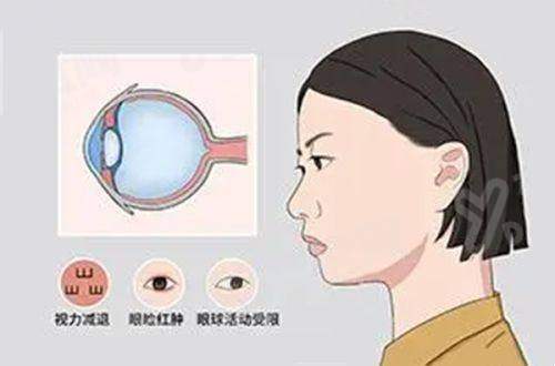 四、徐州二院眼科就医补充信息yanke.yadoo.cn