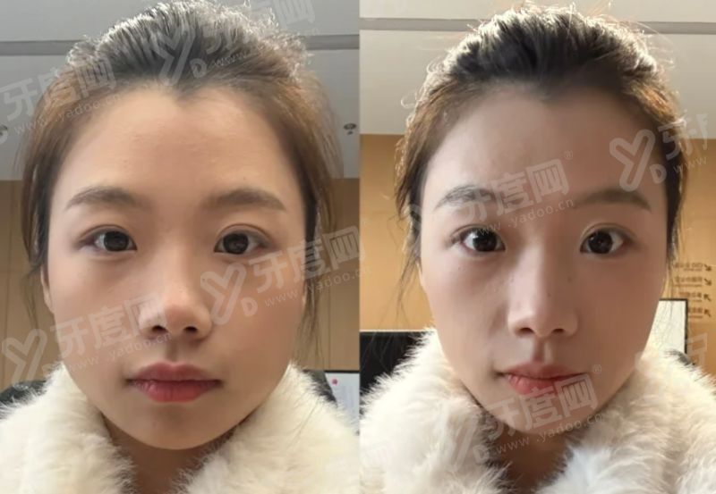 二、男性延长增粗手术哪家医院好yanke.yadoo.cn