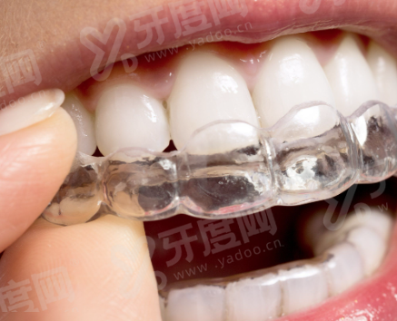 天津口碑好的口腔医院排名前十名：中诺/美奥/爱齿口腔医院排名前三名