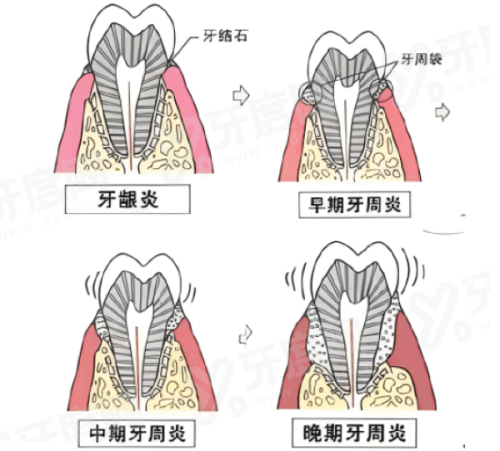 二、绵阳常乐口腔医院价格表？（收费合理透明）yanke.yadoo.cn