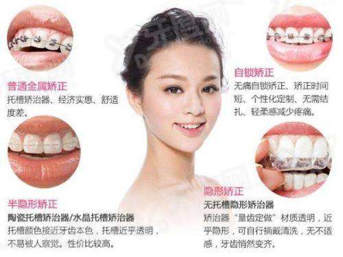 自贡牙齿矫正医院排名榜前十名：前三名是自贡贝美、自贡新桥、自贡华医口腔医院！ 