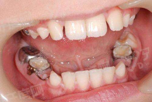 二、自贡市第四人民医院口腔科怎么样？（诊疗实力较强，服务优质）yanke.yadoo.cn