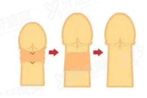 程开祥医生到底是不是九院的？没错，揭秘九院没号原因与背神经修复术