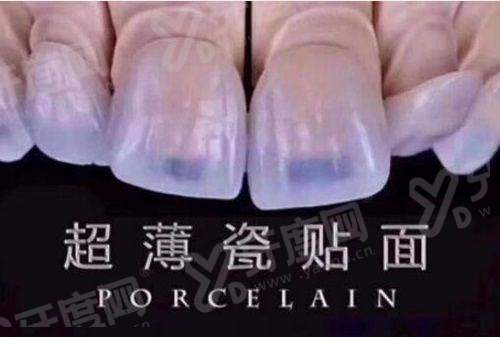 北京京一口腔是正规医院吗？正规可靠！附种植/矫正价格表+详细地址