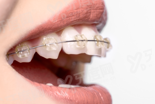 二、浙江拜博口腔医院门店地址电话：杭州/宁波/温州/台州/义乌/舟山/嵊州/等10家拜博口腔地址yanke.yadoo.cn