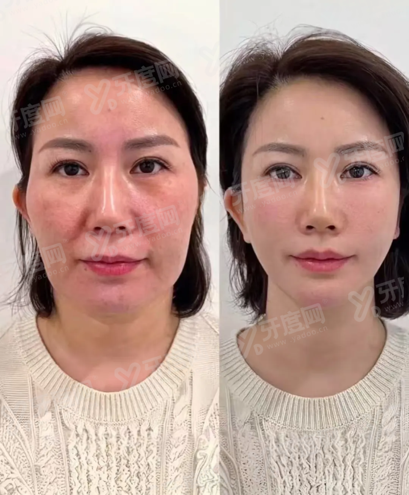 上海李海涛医生擅长项目有哪些？面部年轻化与抗衰老，技术水平较高可预约挂号！