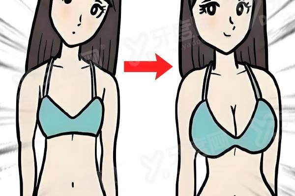 北京缩胸手术哪里做比较好？北京美莱、北京联合丽格第一、北京八大处整形医院这三家医院值得选！