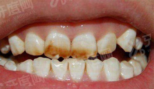 三、北京瑞泰口腔丰台医院怎么样yanke.yadoo.cn