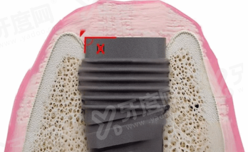 二、济南众牙口腔医院怎么样？（本地连锁10年+，数字化技术与经验医生双保护）yanke.yadoo.cn