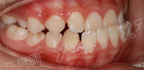 北京瑞泰口腔丰台医院地址在哪？在南四环西路，附价格表+地址公交路线