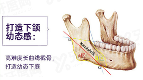 深圳人民医院于丽去眼袋怎么样？技术精湛效果好，面诊后手术时间及医生案例揭秘