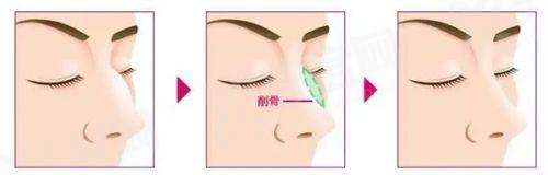 二、男科预约报名怎么预约yanke.yadoo.cn