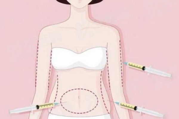 罗盛康隆胸怎么收费？收费在1-30万元左右，隆胸效果自然宛如天生！ 