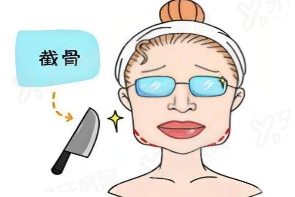 赵延峰磨骨风险大吗？结合千例案例，个性化方案降低风险安心变美