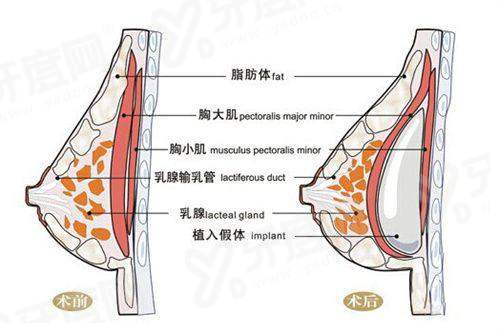 想做北京缩胸手术？唐欣预约挂号方式大揭秘，含出诊时间