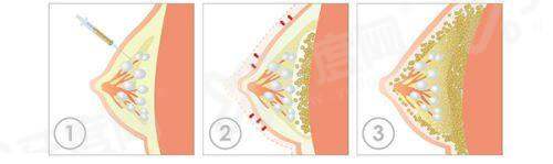 二、深圳艺星医疗美容医院预约挂号指南yanke.yadoo.cn