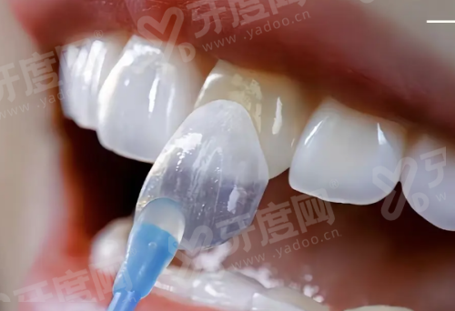 二、喀什中诺口腔医院怎么样？（正规资质保护，技术设备领跑）yanke.yadoo.cn