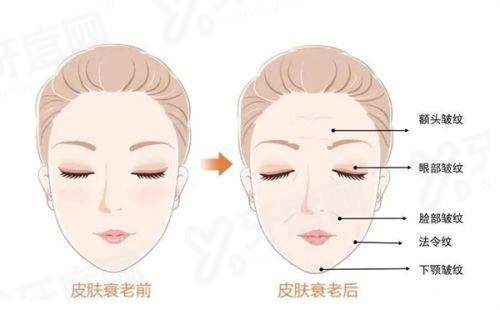 二、广州黄广香擅长什么手术？黄广香擅长拉皮/隆胸等？yanke.yadoo.cn