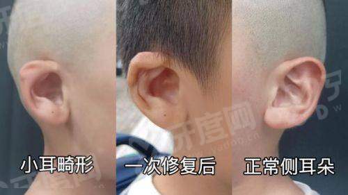 二、刘双立磨骨属于什么水平yanke.yadoo.cn