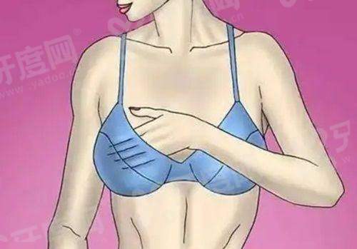 菲琳瑟尔骨胶原价格表：面部填充3800/眼部周边2800元起