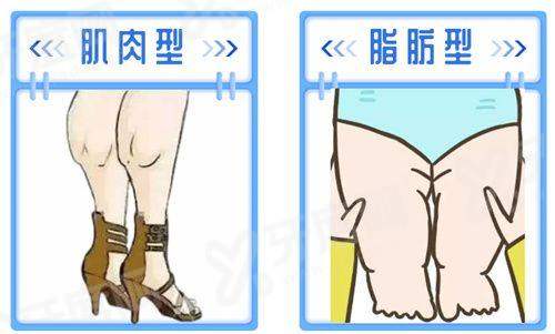 二、菲琳瑟尔骨胶原可以填充吗yanke.yadoo.cn