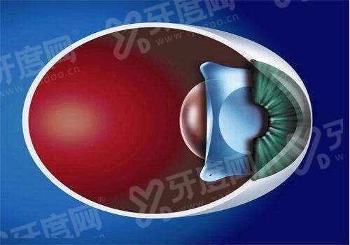 三、昆明爱尔眼科医院预约挂号？yanke.yadoo.cn