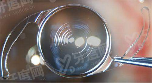 二、郭玉瑞医生面部提升咋样yanke.yadoo.cn