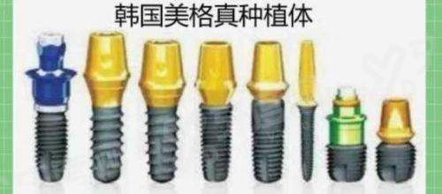 韩国美格真种植牙怎么样？属中高端档次，寿命达15至20年！含优缺点及价格表