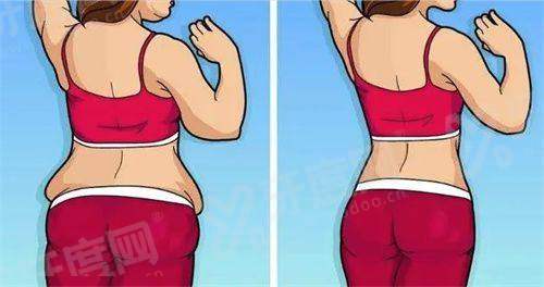 万晓楠医生抽脂做一次手术多少钱？面部抽脂3800/上肢抽脂5800元起