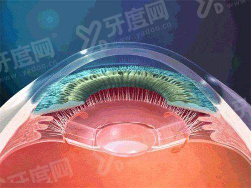 浙二医院眼科在哪个院区？浙江大学眼科医院，附24小时电话咨询及地铁口信息