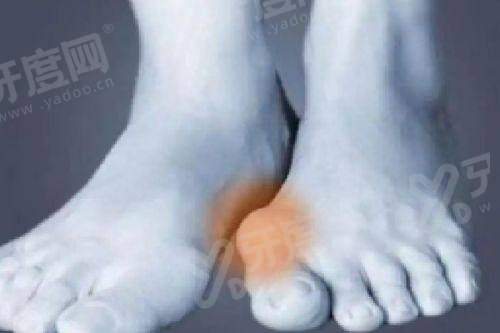 国内私处整形医院入珠多少钱？硅胶4k/天然宝石6k/金属珠5.5k元起