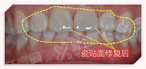 四、上海同口名佑口腔医院预约挂号方式及流程yanke.yadoo.cn