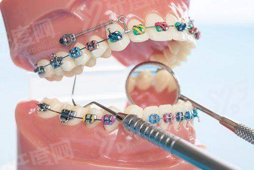 二、利多齿种植牙怎么样？四级钛材质，质量好yanke.yadoo.cn