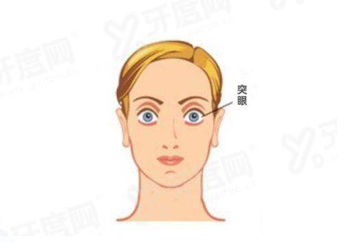 二、重庆永川爱尔眼科医院价格表?(收费透明合理,多种项目满足需求)yanke.yadoo.cn