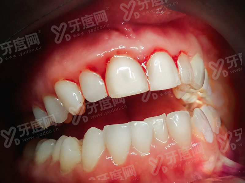 四、预约挂号方式yanke.yadoo.cn